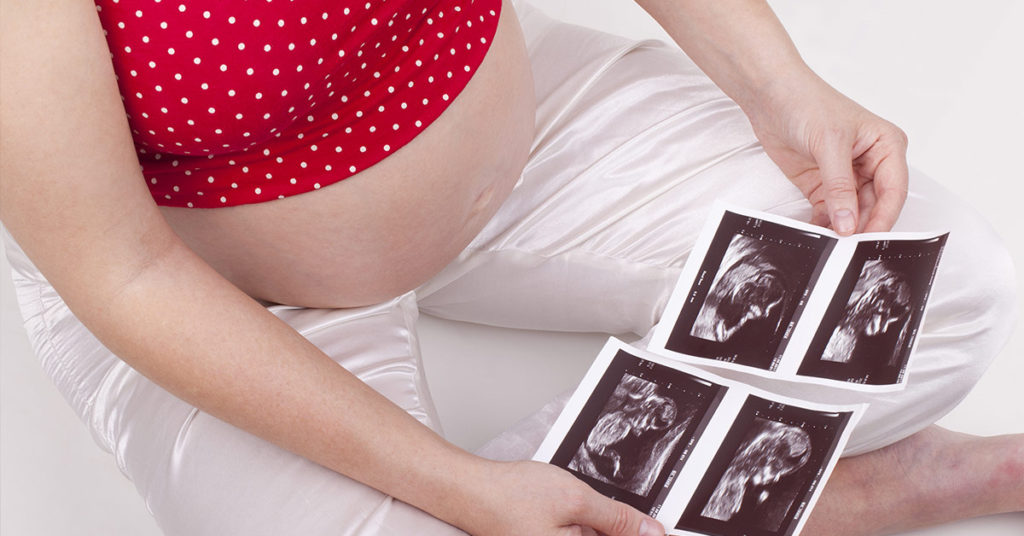 Mom-to-be conceives a third baby — while pregnant with twins - Featured image