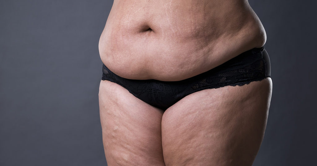 Mom Bods Deserve To Be Accepted Just As Much As Dad Bods - Featured image