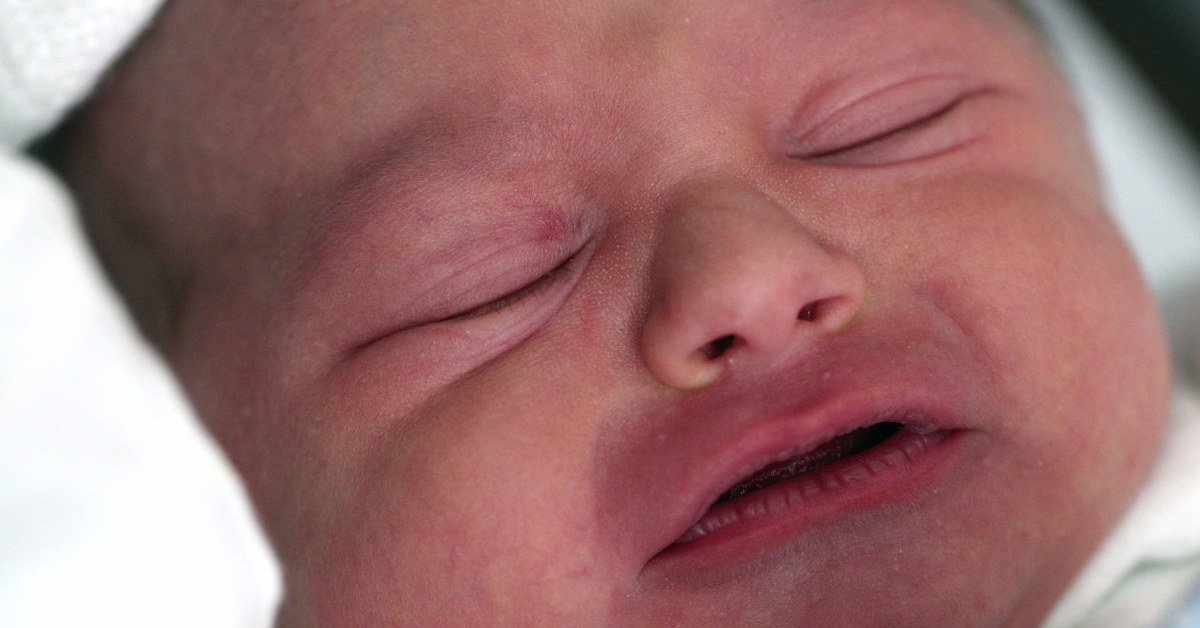 Close up of baby's face with eyes wincing with a look of discomfort