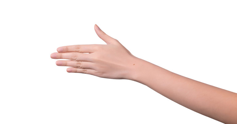 Women All Over the World Are Realizing That They Share the Same Mysterious Freckle - Featured image