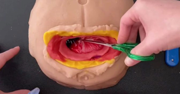 Mom dragged for using Play-Doh to demonstrate C-section surgery to son - Featured image