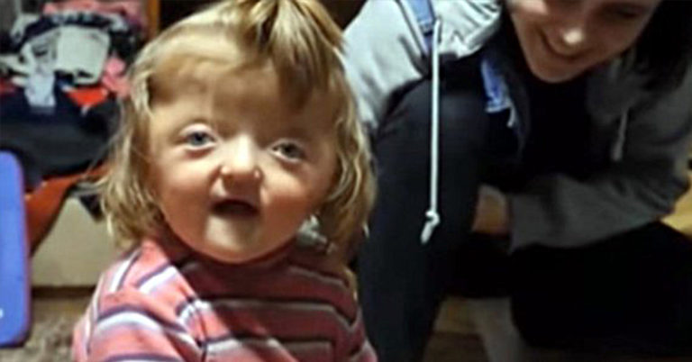 2-year-old not admitted to nursery because her deformed skull is ‘too scary’ - Featured image