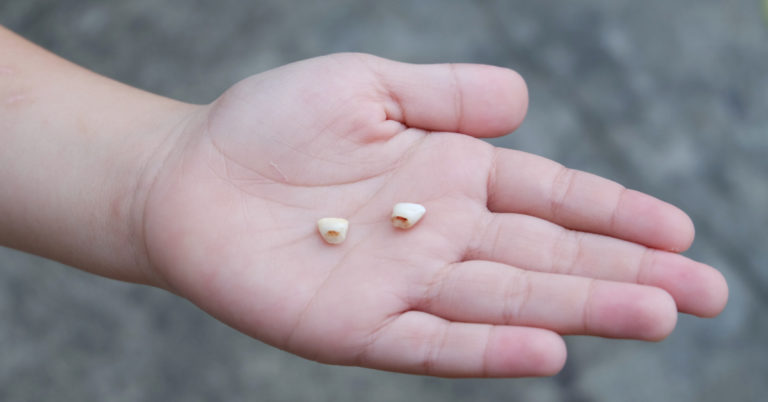 Attention, Parents! You Might Want To Hold On To Your Kids’ Baby Teeth - Featured image