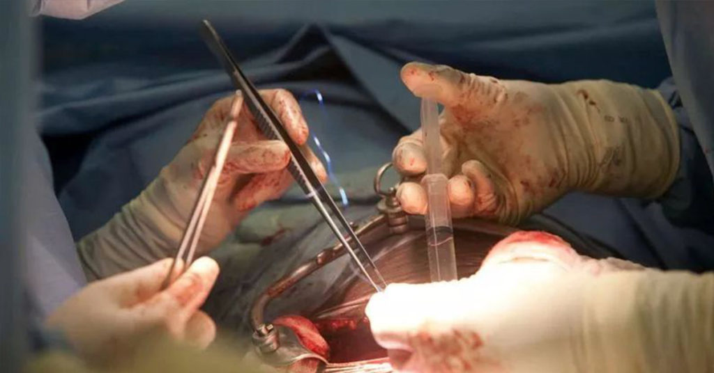 Parents Refuse to Donate Kidney to Dying Child Because She Is a Girl - Featured image