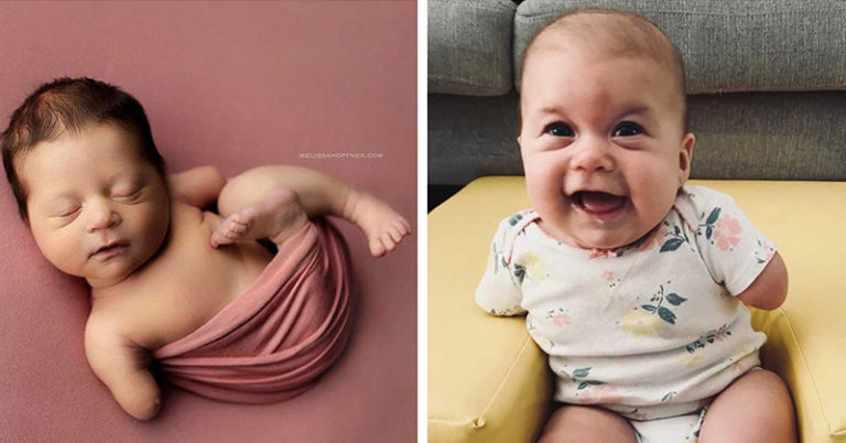 My Husband’s Reaction to Finding Out Our Baby Girl Has No Arms or Hands Put the Doctors to Shame - Featured image