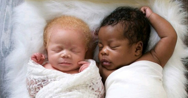 Photographer Gives Birth to Twins, One Dark-Skinned and the Other Albino, and They Are a Sight For Sore Eyes - Featured image