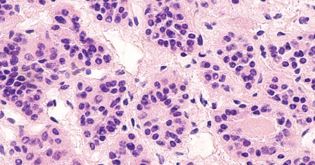 ‘I was going crazy’: Woman’s mystery symptoms lead to startling diagnosis - Featured image