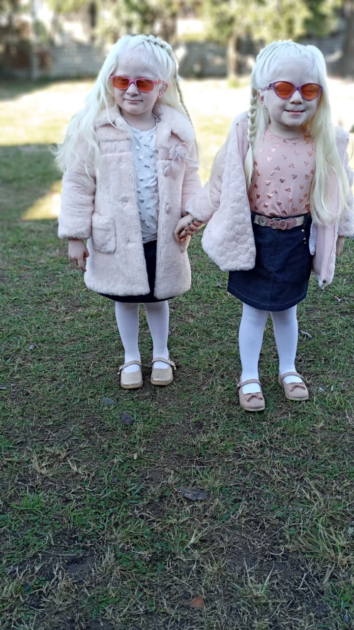 Mom delivers twin girls with matching snow-white hair, and their ...