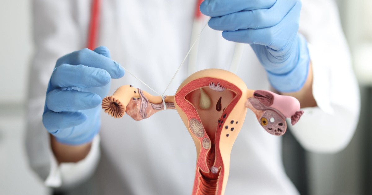 Gynecologist shows how to ligate the fallopian tubes on training model of female reproductive system