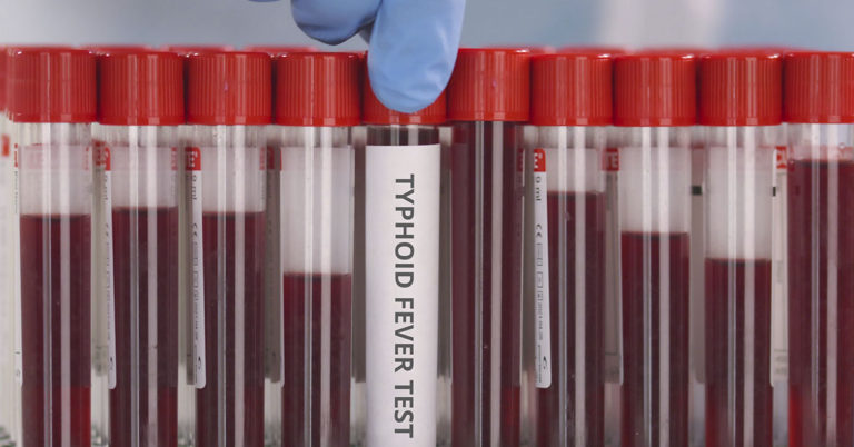 An Ancient Killer Is Rapidly Becoming Resistant to Antibiotics, Scientists Warn - Featured image