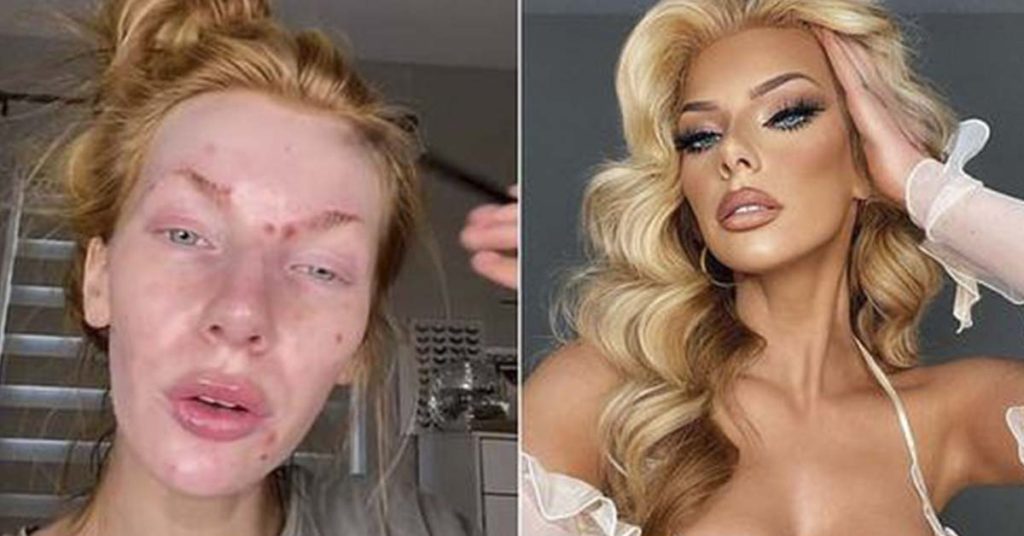 Woman dubbed as TikTok's biggest catfish shares before and after pics