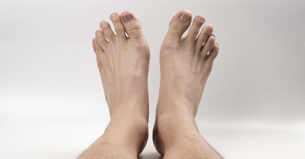 Toe Shortening Is A Thing And It’s More Common Than You Think - Featured image
