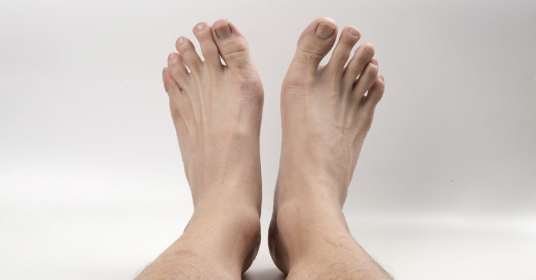 Toe Shortening Is A Thing And It’s More Common Than You Think - Featured image
