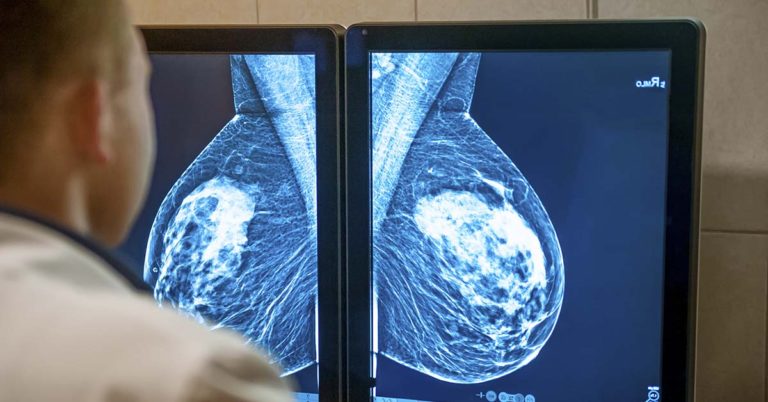 A 29-year-old woman with a lump in her breast said she was refused a mammogram because she was too young. She now has stage 4 cancer. - Featured image