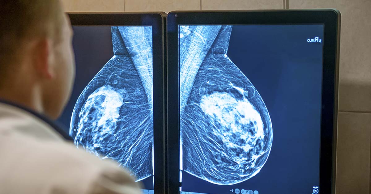 mammogram of breast tissue