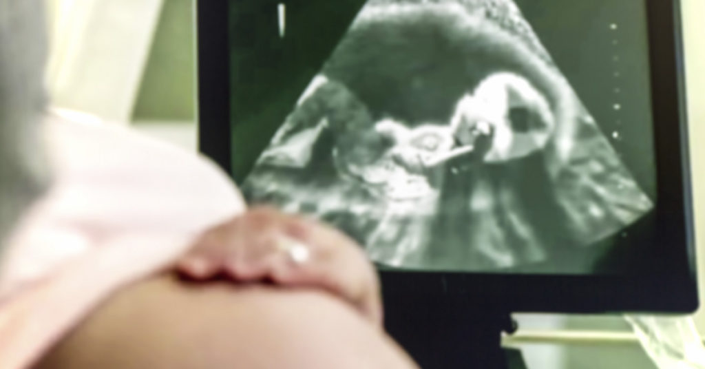 Babies smile over carrots and scowl over kale inside the womb - Featured image