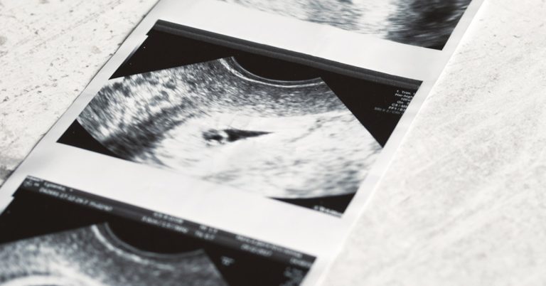 Parents welcome twins from embryos frozen 30 years ago - Featured image