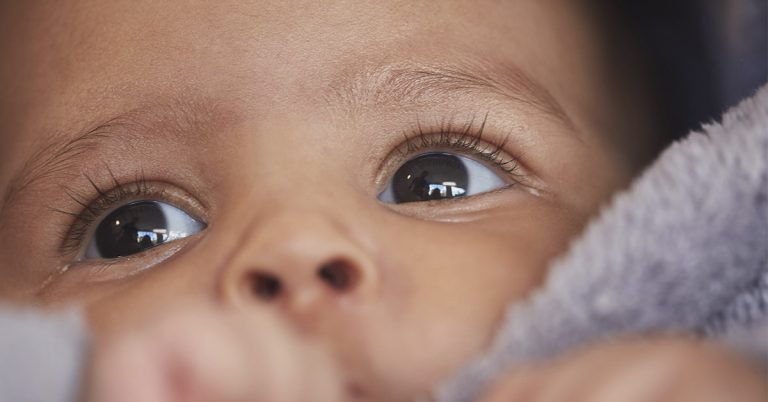 This Little Girl’s Big, Beautiful Eyes Are Due to a Rare Medical Condition - Featured image