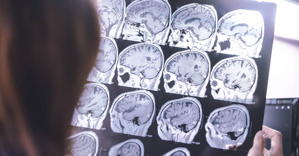 ‘I am losing my little girl to dementia’ - Featured image