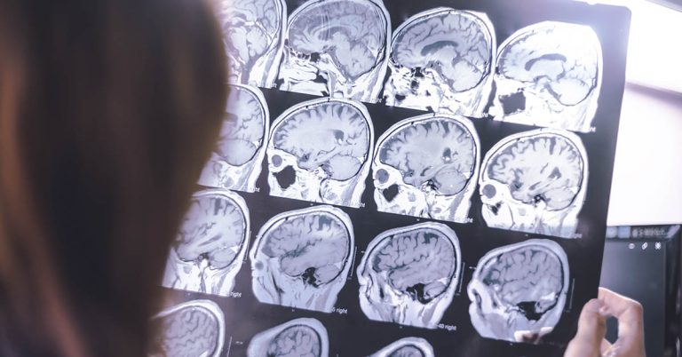 ‘I am losing my little girl to dementia’ - Featured image