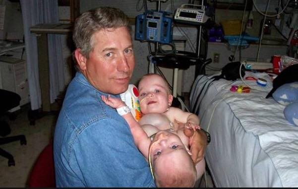 Jeff Garrison and the conjoined twins