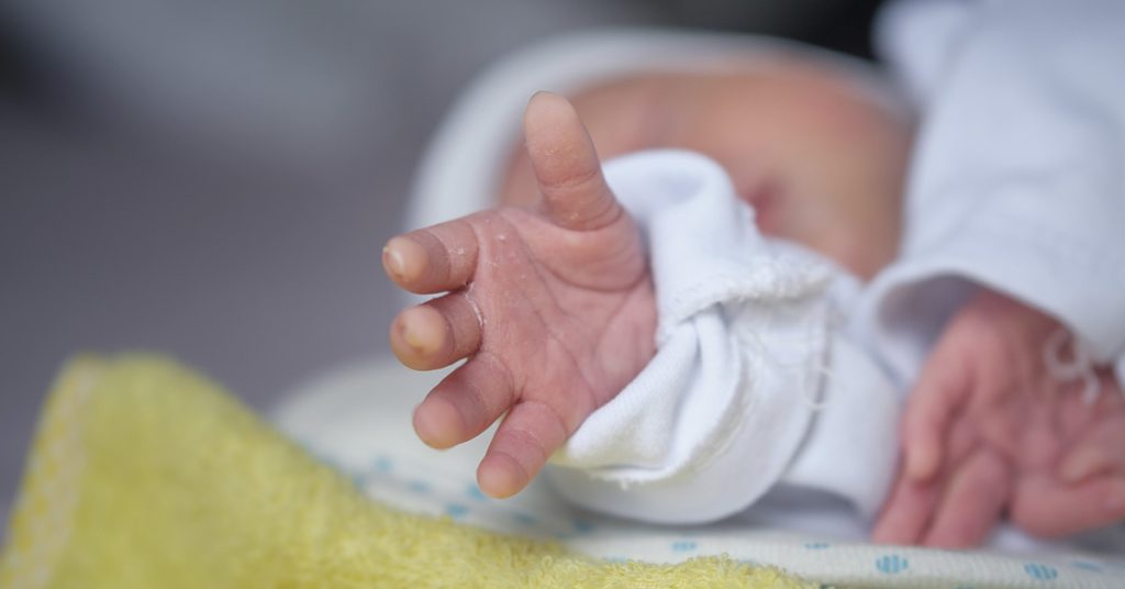 Newborn Was Called Ugly & Looked Like ‘A Villager’ – Now She’s Grown into an ‘Absolutely Beautiful Little Lady’ - Featured image