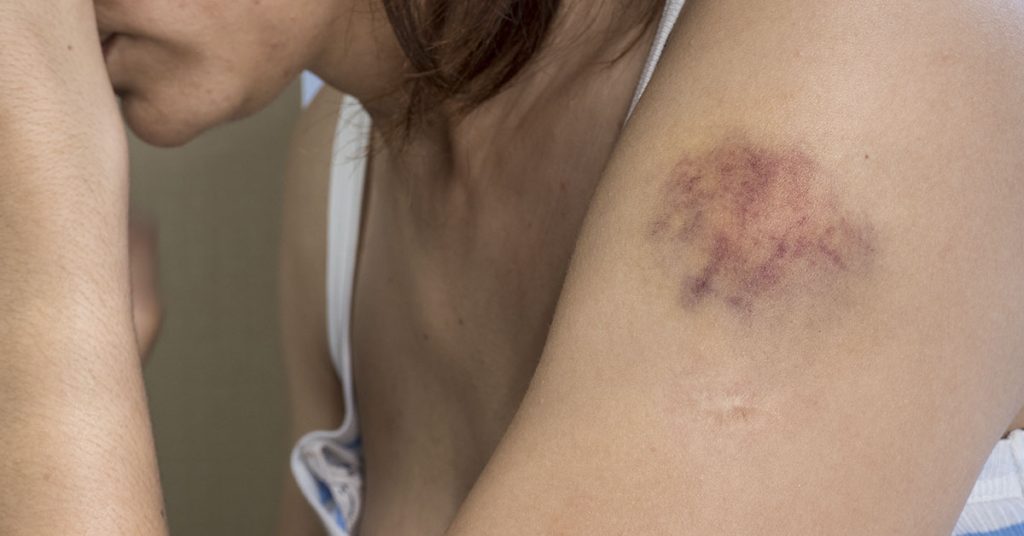 Mom beaten so badly by boyfriend she wrote ‘goodbye letters’ to her toddler - Featured image