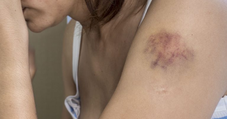 Mom beaten so badly by boyfriend she wrote ‘goodbye letters’ to her toddler - Featured image