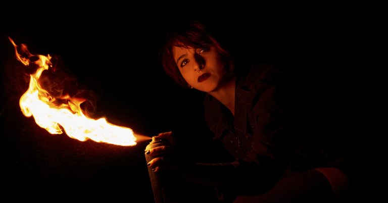 TikTok challenge leaves teen with burns on 75% of his body - Featured image