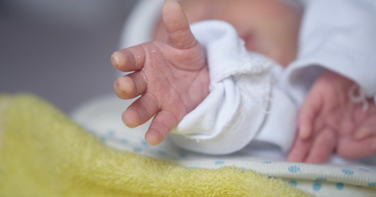Baby Mocked for Having White Hair – But Wait till You See How He Looks Years Later - Featured image
