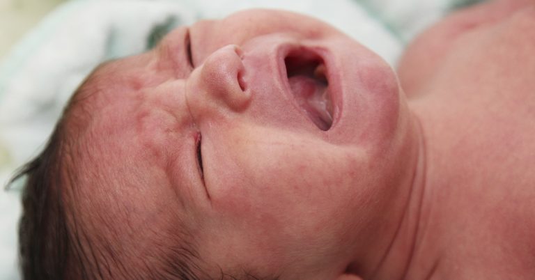 Doctors carry out emergency C-section and deliver a baby with a rare skin condition - Featured image