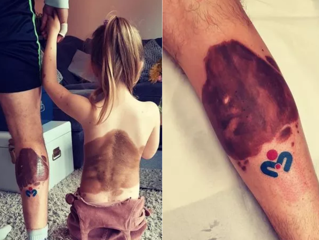 Dad gets tattoo to match his daughter's birthmark