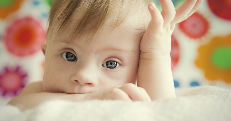 Doctors suggested girl with Down syndrome be institutionalized – fast-forward 15 years and she’s a top model - Featured image