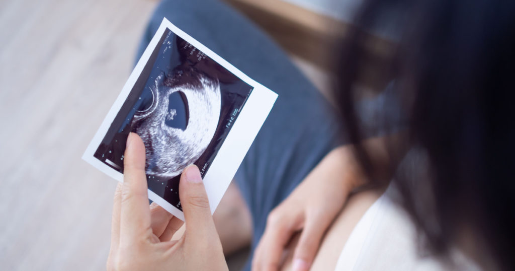 A pregnant woman is looking at an ultrasound photo of fetus. Mother gently touches the baby on stomach.Women are pregnant for 2-3 days or during the first trimester.
