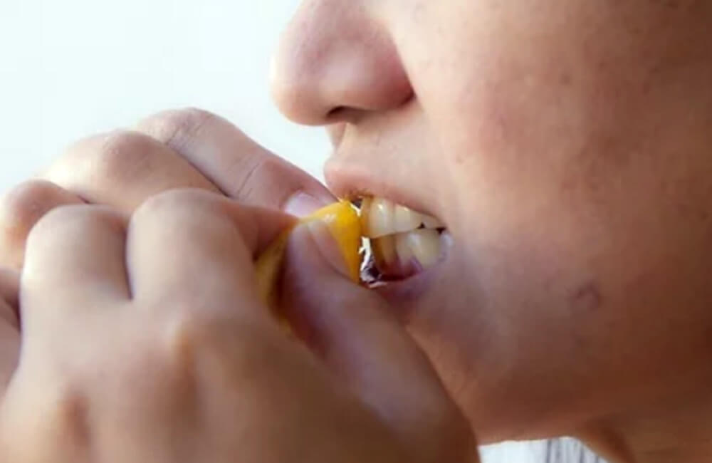 Enthusiasts of this beauty hack suggest that rubbing the inside of the banana peel on the teeth and leaving it for a few minutes can produce a whitening effect.