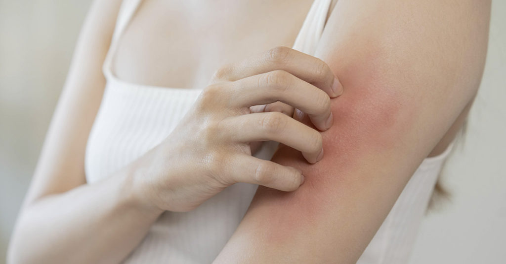 Help Skin Problems Naturally: Home Remedies for Itchy Skin - Featured image