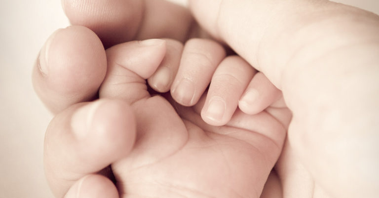 Parents Chose to Remove Their Baby’s Birthmark to Avoid the Rudeness of Others - Featured image