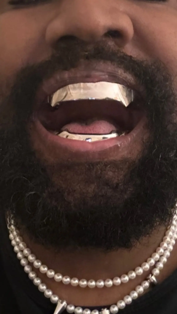 Kanye West's titanium teeth