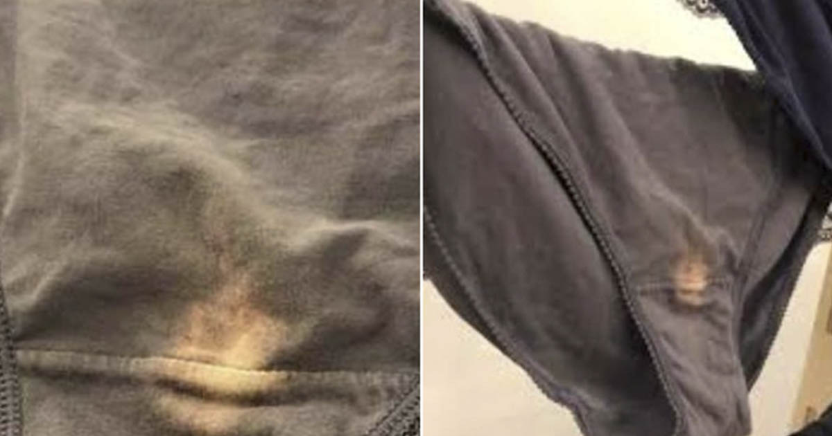 Bleach Patches On Your Underwear Where Do They Come From? Secret Life Of Mom