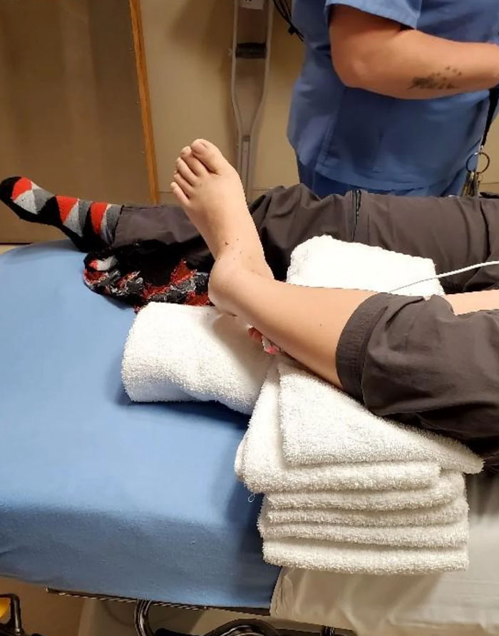 A Dislocated Ankle