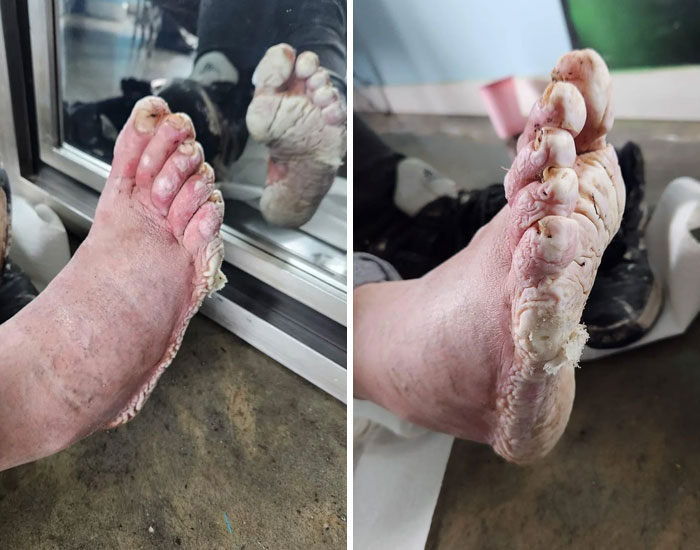 disturbing photos Severe Trench Foot