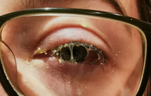 Disgusting Eye 35 Disturbing Photos That Made People Look Away : Secret Life Of Mom