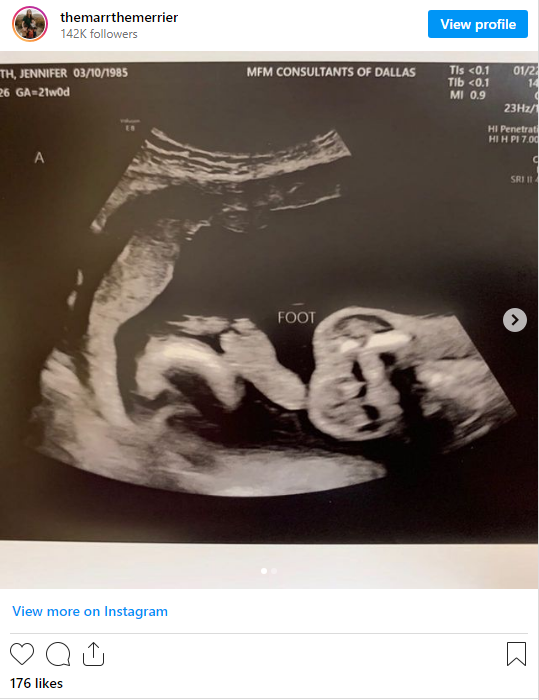 Instagram baby in utero