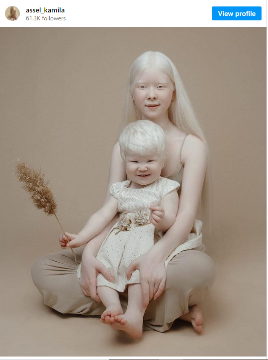 albino sisters