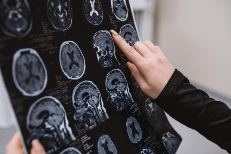 Researchers Find 2 New Dementia Risk Factors You Need To Be Aware Of - Featured image