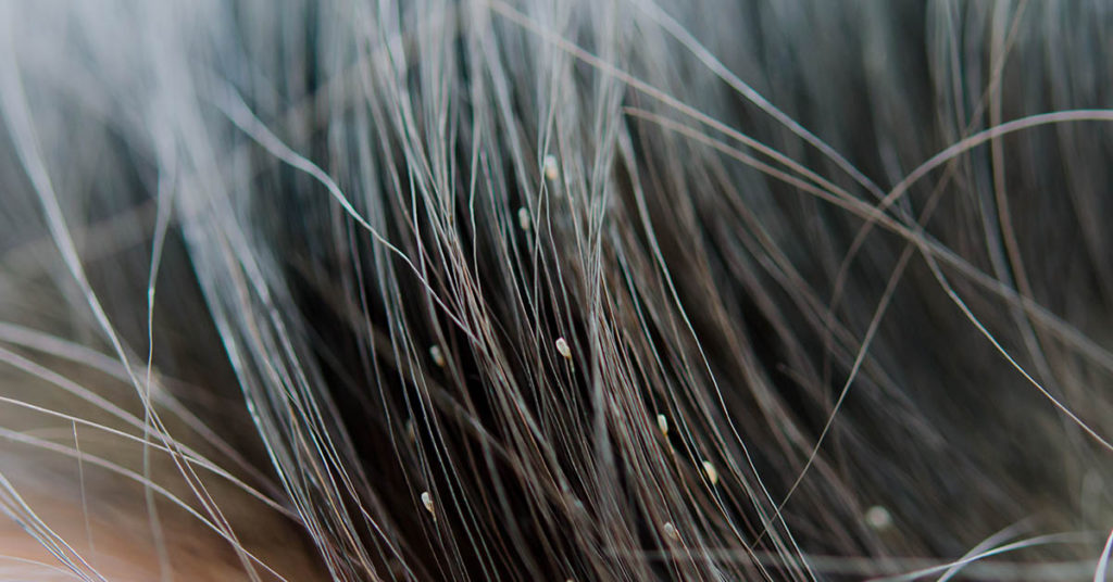 How to Prevent and Treat Head Lice in Children (and Adults) - Featured image