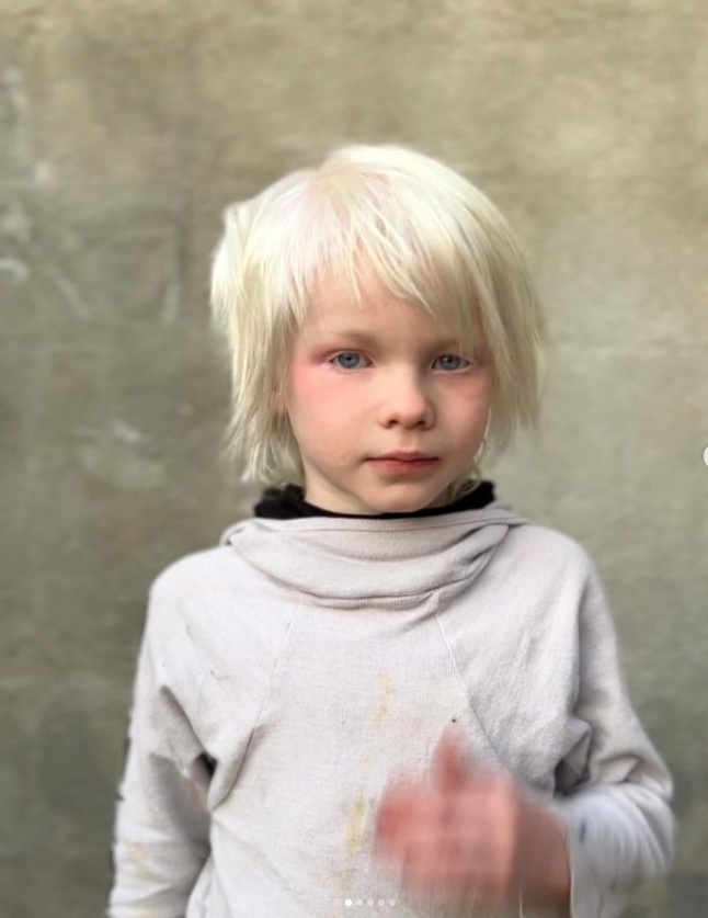 instagram pic of white hair child