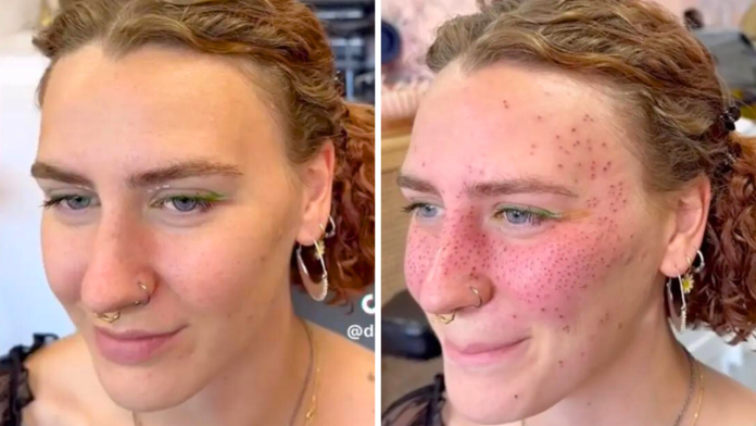 Foxglore's client, before and after her freckle tattoos