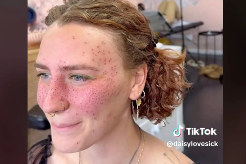 Foxglore's client, after her Freckle tattoos