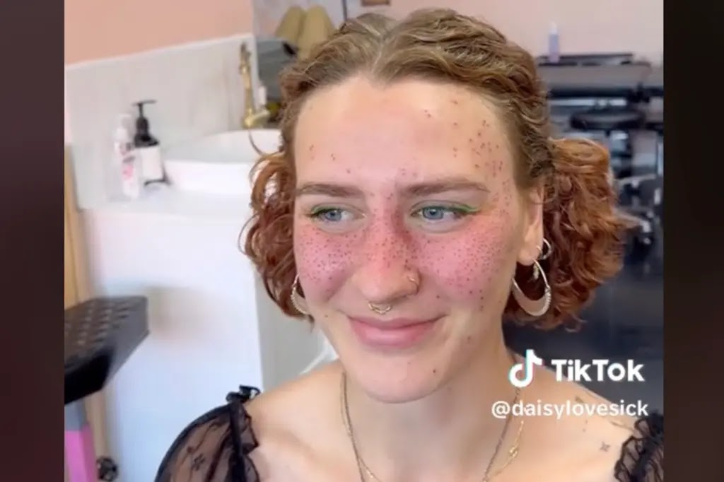 Foxglore's client and her face filled with freckle tattoos